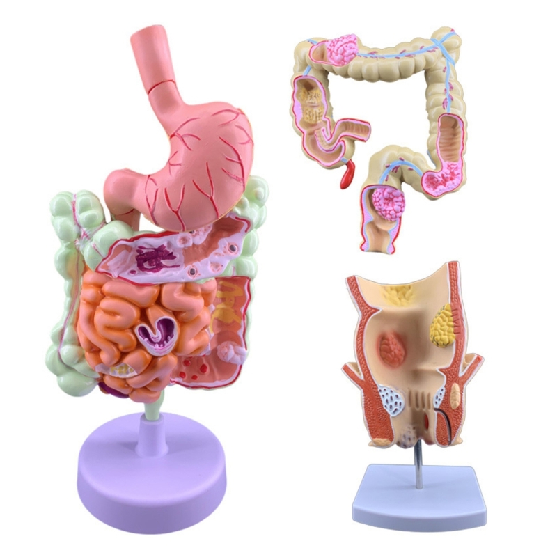 Q6PA 3D-Pathologie-Lehrmodell, – Medical Lab Observer Bewertung und Preis