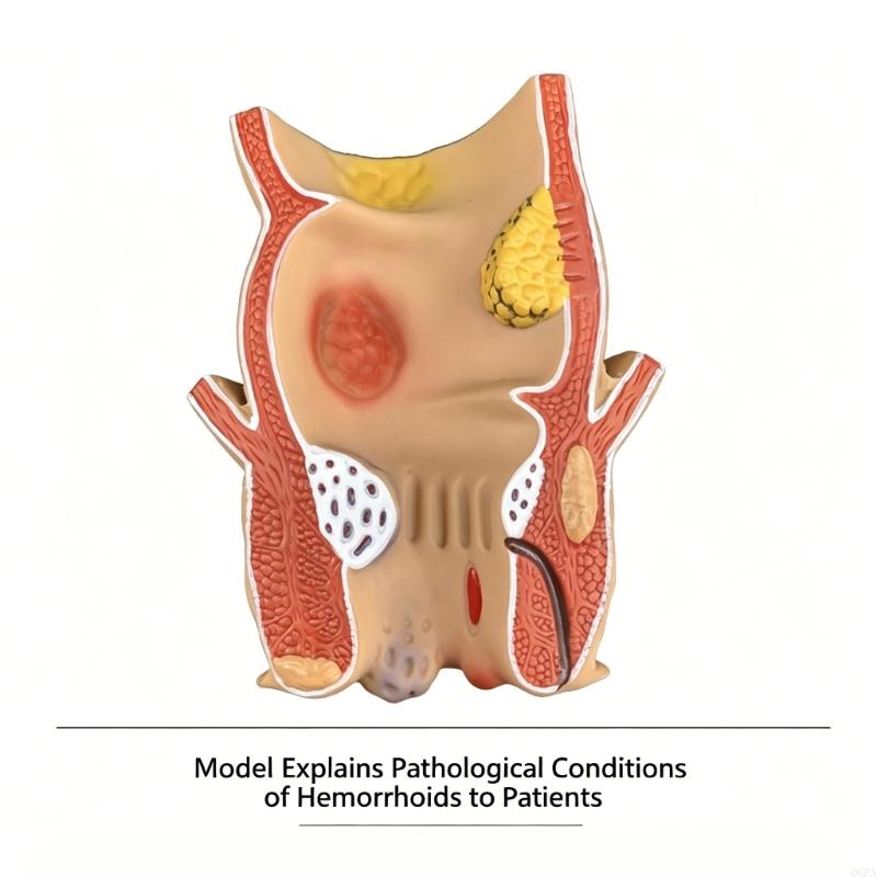 Q6PA 3D-Pathologie-Lehrmodell, – Medical Lab Observer Bewertung und Preis
